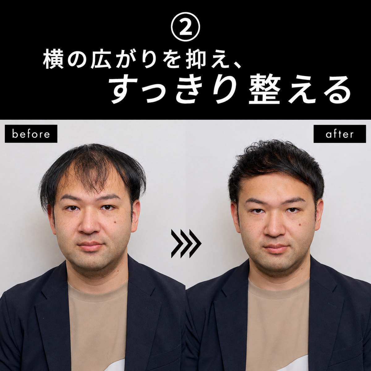 ビフォーアフター 横の広がりを抑えすっきり整える